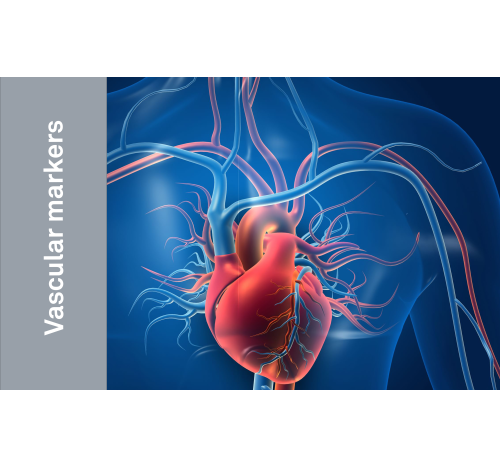 human-low-density-lipoprotein