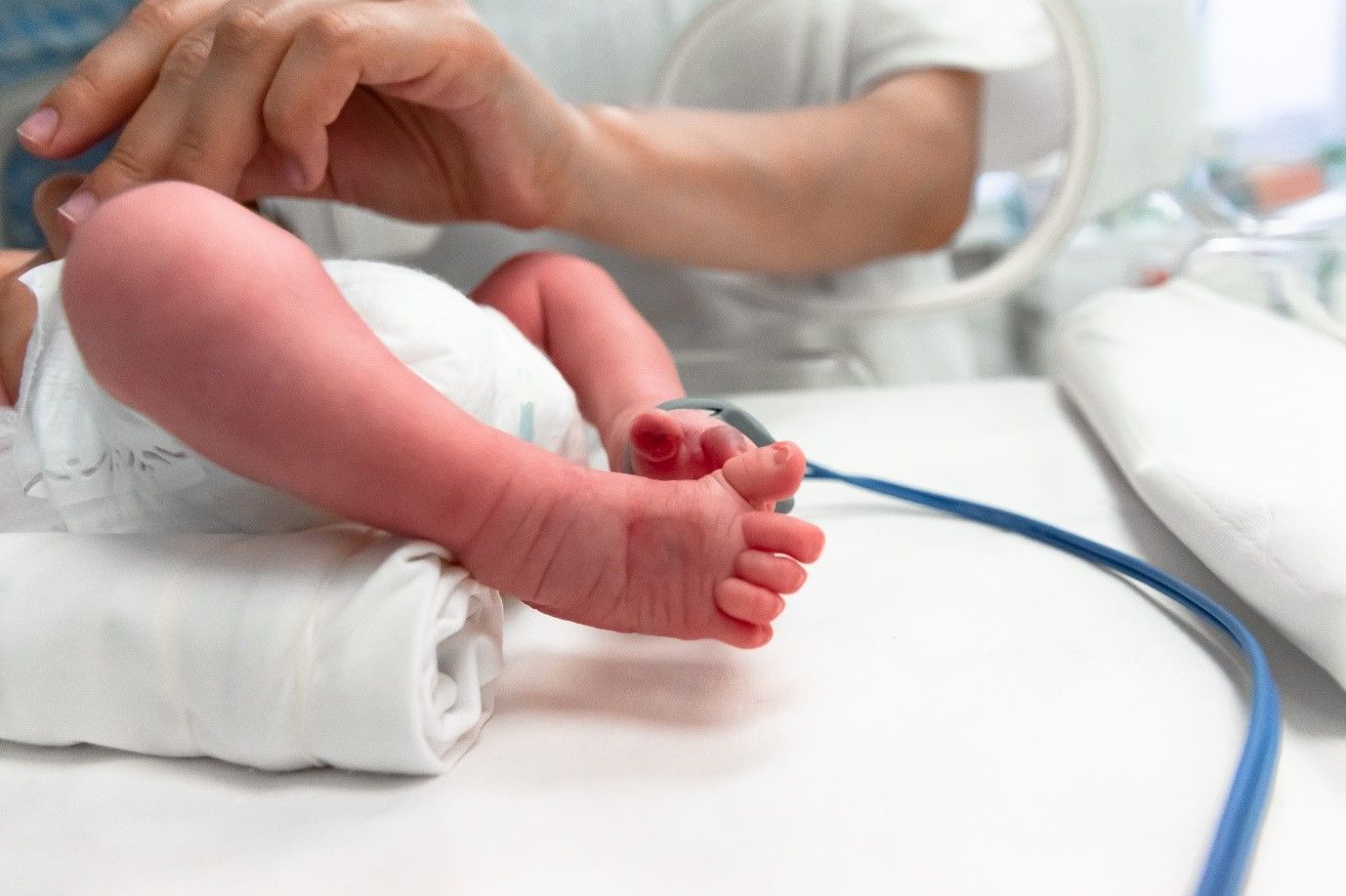 Newborn with medical monitoring, illustrating advances in neonatal infection diagnostics